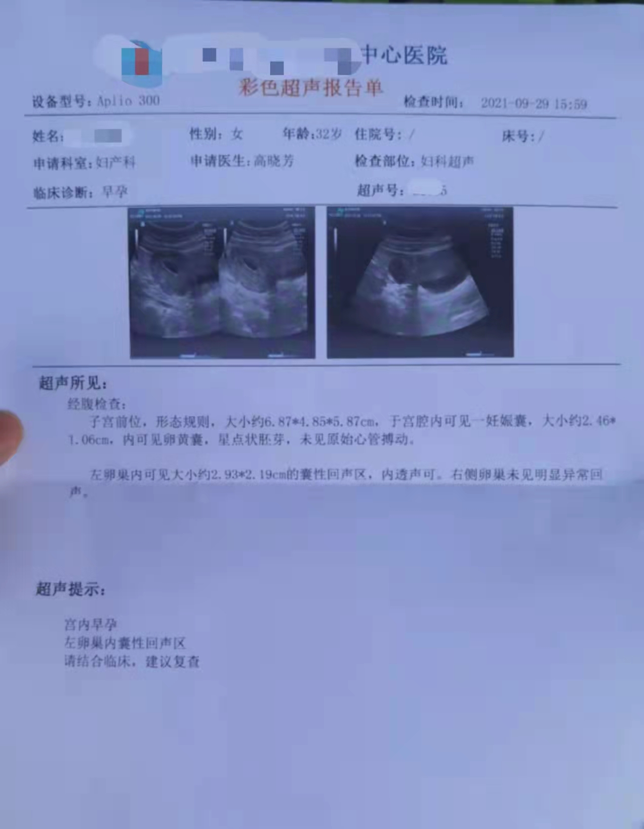 重庆妇产医院孕检